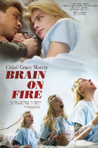 Brain on Fire [HD] (2017 CB01)